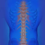 Understanding Transverse Myelitis: Causes, Symptoms, and Treatment Options